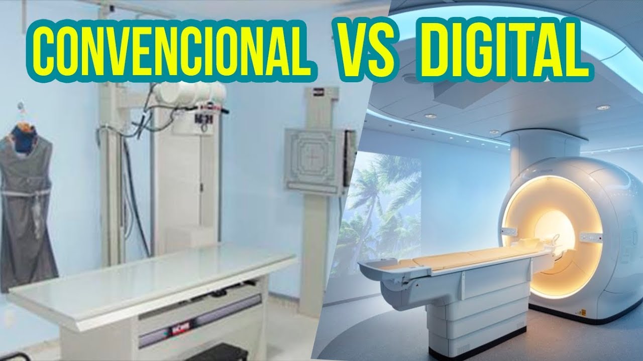 CONVENTIONAL VS DIGITAL RADIOLOGY