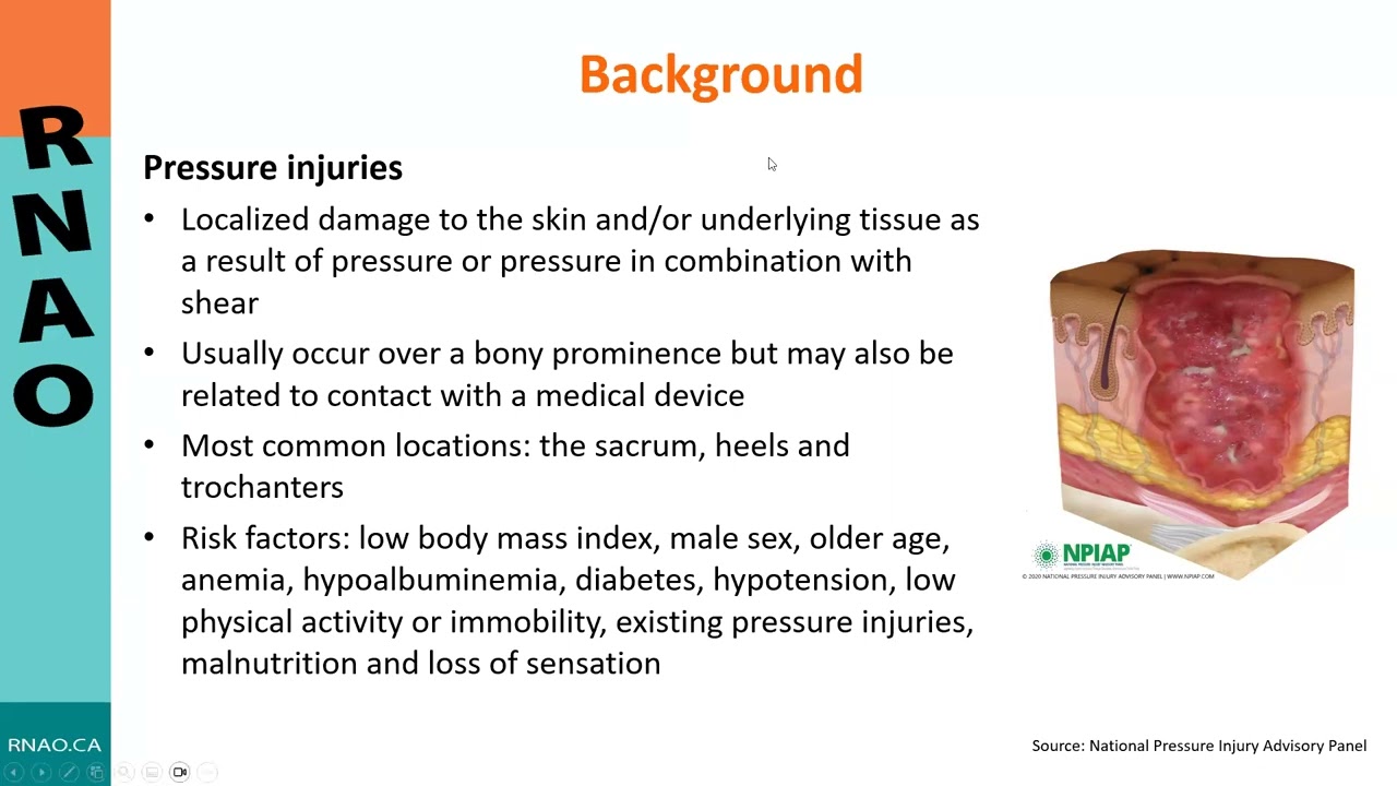 Introduction of the Pressure injury management: Risk assessment, prevention and treatment guideline