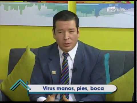 Virus manos, pies, boca 