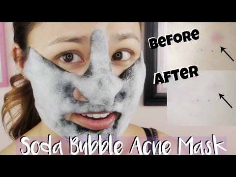 First Impressions ♥ Mediheal Mogongtox Soda Bubble Acne Sheet Mask Video