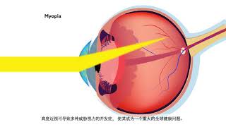 Learn about the eye conditions most common to Asia in a new special focus of Eye