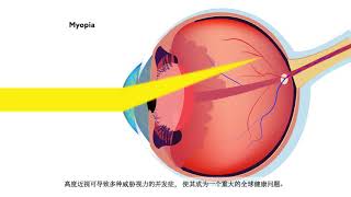 Learn about the eye conditions most common to Asia in a new special focus of Eye