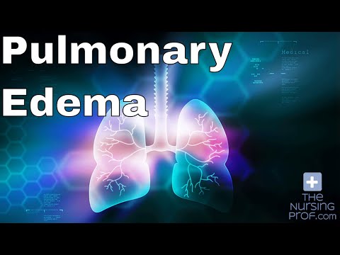 Nursing Emergencies: Pulmonary Edema