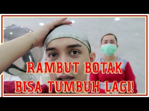 INI LOH TERNYATA PENYEBAB RAMBUT BOTAK ! (Part 1) | Ichsan Akbar