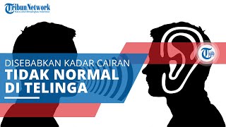 Meniere, Penyakit Telinga Disebabkan karena Ketidaknormalan Kadar Cairan pada Telinga Bagian Dalam