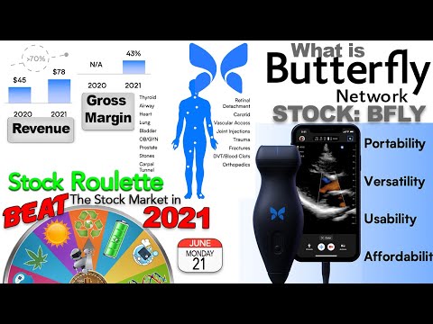 What is Butterfly Network? Is BFLY stock a buy now?  Week 25 of 52 of Stock Roulette.