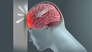 How Traumatic Brain Injury (TBI) Affects Brain Cells - New Research Could Lead to New Treatments