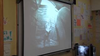 The Future is in Their Hands - Help ARAN Reach Even More