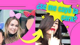 Bolsas de bichat antes y después ¿vale la pena...a tu edad