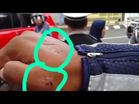 Emak-emak preman pasar tidak terima di tilang, gigit tangan polisi