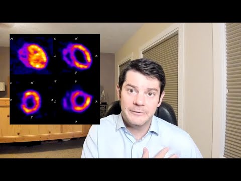 Nuclear Waste Series - 3: Reprocessing and Recycling Spent Fuel