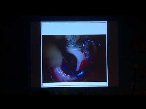 AIOC2019 - GP120 - Tips and Algorithms ( Retinal Detachment )