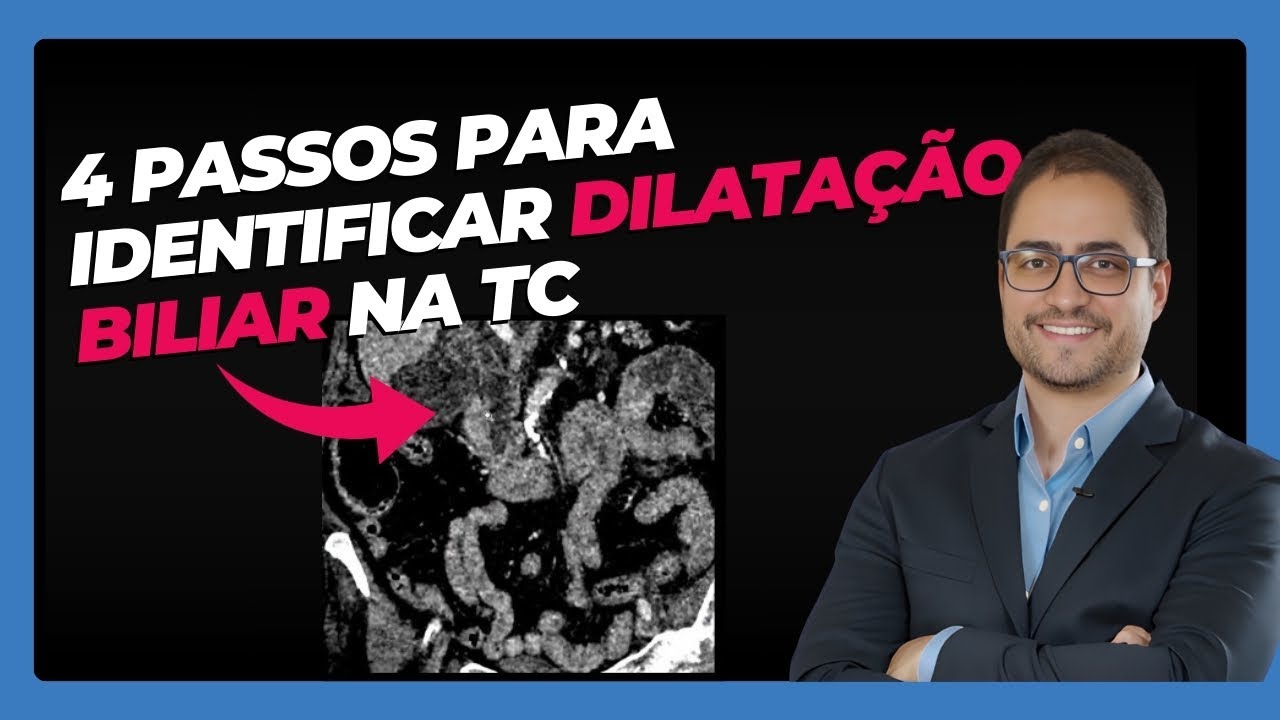 4 Passos para Identificar Dilatação Biliar na TC