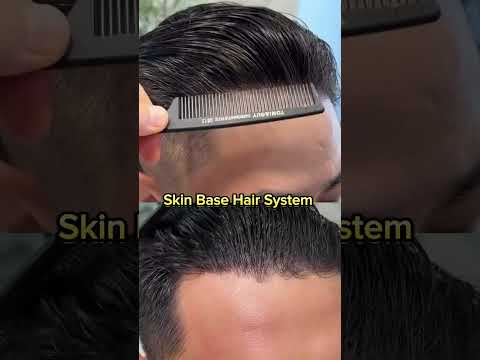 Skin Base Hair Patch System I 100 % Natural Look #hairreplacement #hairsystem