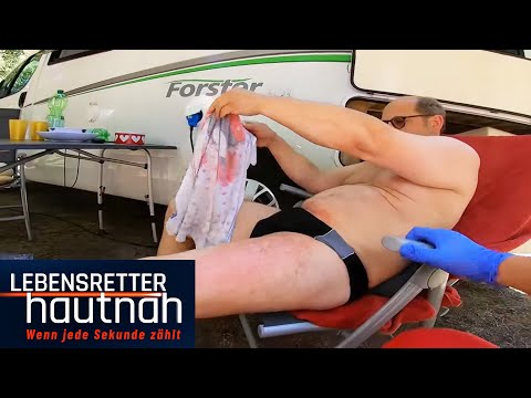 Schlimmer Notfall: Schwere Verbrennungen auf dem Campingplatz!! | Lebensretter hautnah | SAT.1