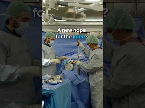 New Hope For The Knee? | Dw Documentary