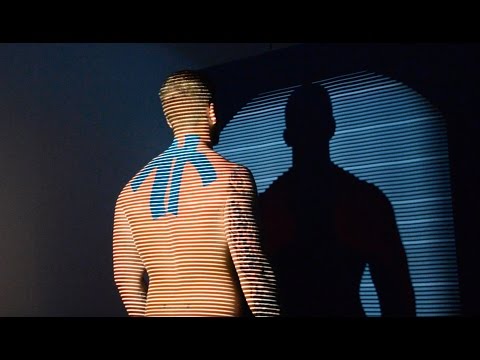 Rückenscan bei Rückenschmerzen