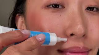 Top 7 Most Effective Acne Scar Removal Treatments That Actually Work