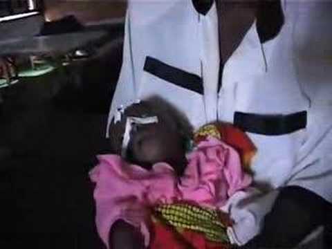 comment soigner le kwashiorkor