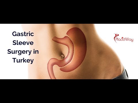 Logo of Going Home with a New Body Using Gastric Sleeve in Turkey