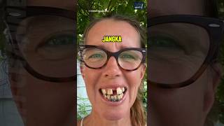 Download lagu Proses Perubahan Gigi Wanita ini Sungguh Luar Biasa 🤯 mp3