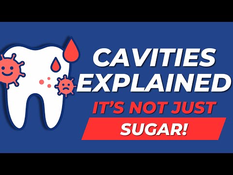 What Really Causes Cavities?