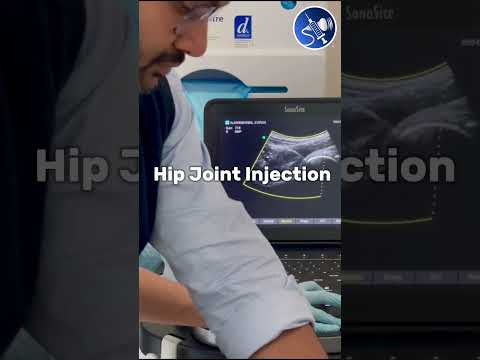 Welcome to my new series GUIDE THE NEEDLE! Part 1 Hip joint injection #mskus #ultrasound