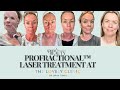 Vlog Of My Skin Re Surfacing ProFractional Laser Treatment All You Need To Know