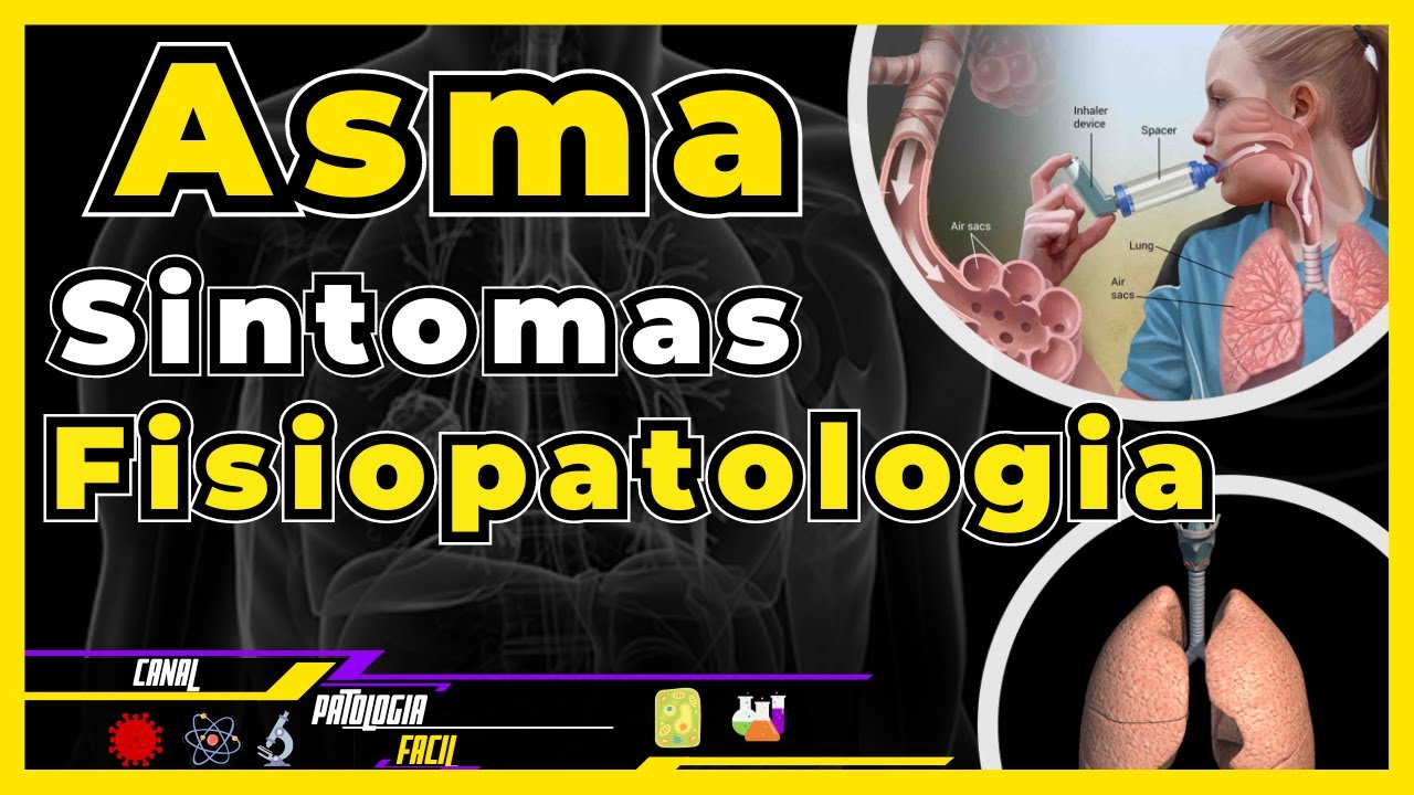 Fisiopatologia da asma (Definição, sintomas e fatores desencadeantes) [Atualizado 2021]