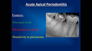 Endodontic emergency treatment