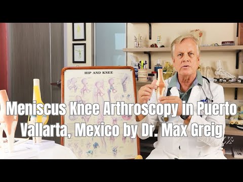 Meniscus Knee Arthroscopy in Puerto Vallarta, Mexico by Dr. Max Greig