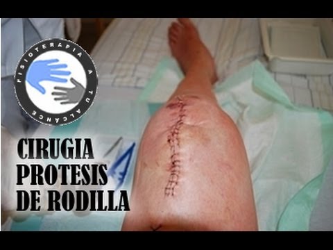 Para lo que es necesario radiografías de la columna cervical Dolor en la parte posterior bajo los omóplatos