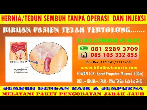 Anna kurkurina menurunkan berat badan Saya kehilangan berat badan dan ginekomastia