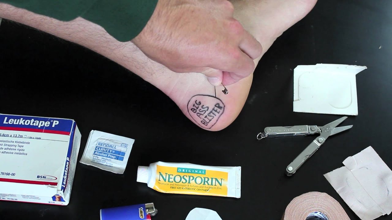 How To Clean And Dress Blisters For Hiking - YouTube