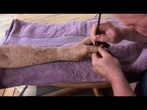 Hand massage Brandon Raynor working on Brian's hand