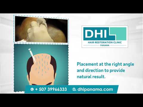 Hair Transplant with the DHI Technique
