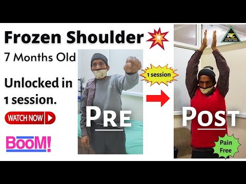 Frozen Shoulder Treatment 7 Stage Shoulder Mobilization Technique Spencer s Technique