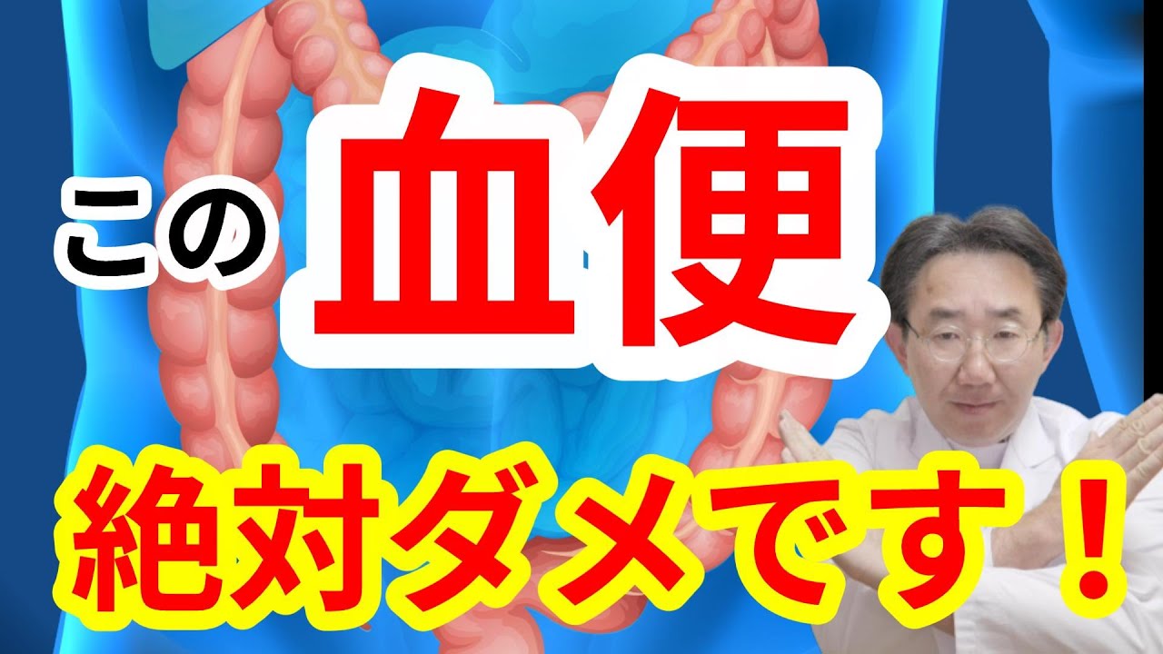 【大腸がん】らしい血便と、そうでない血便の違い！　～血便からわかるさまざまな病気～