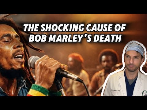 The Shocking Cause of Bob Marley’s death (explained by Nick Pappas MD)  #bobmarley