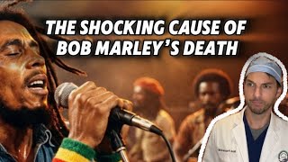 The Shocking Cause of Bob Marley’s death (explained by Nick Pappas MD)  #bobmarley