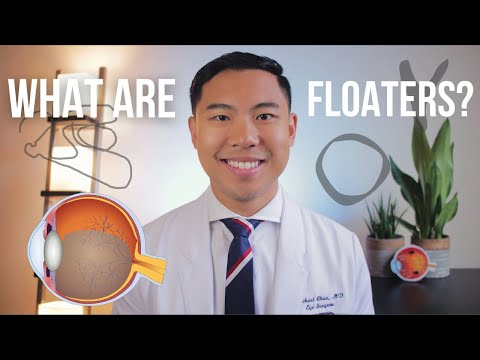 What are Floaters? Explained by an MD