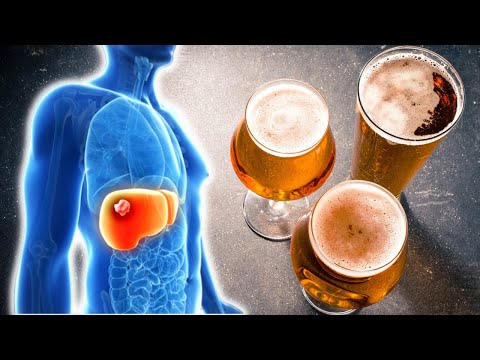 Das passiert mit deinem Körper, wenn du jeden tag Bier trinkst! 🍺