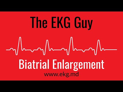 Biatrial Enlargement EKG l The EKG Guy - www.ekg.md