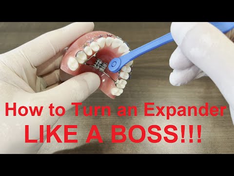 How to Turn an Expander