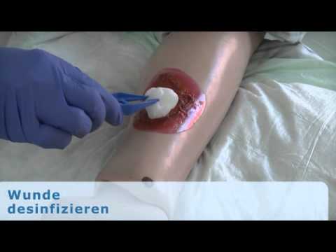 Ellenbogen Schmerzbehandlung Medikamente von Schmerzen in Osteochondrose der Halswirbelsäule