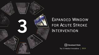 Expanded Window for Acute Stroke Intervention