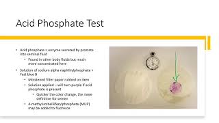 042   Forensic Characteristics of Semen