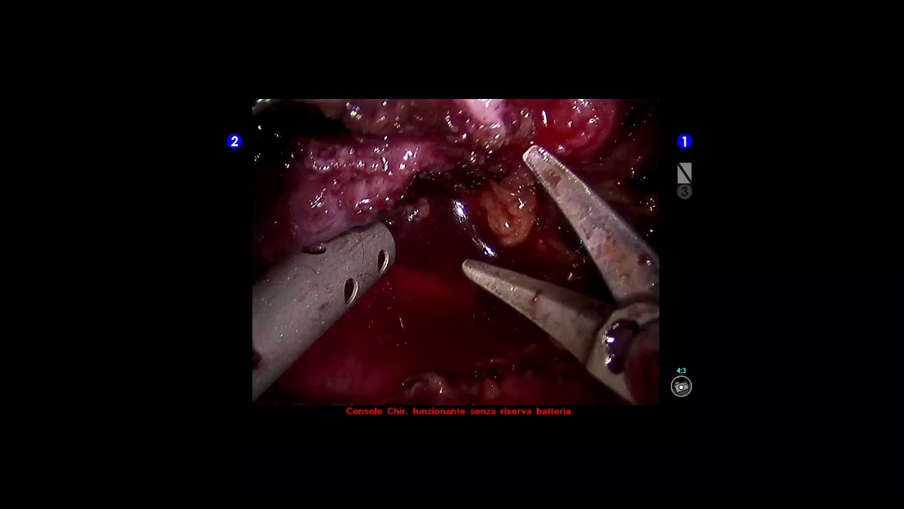 Pier Andrea Della Camera-92