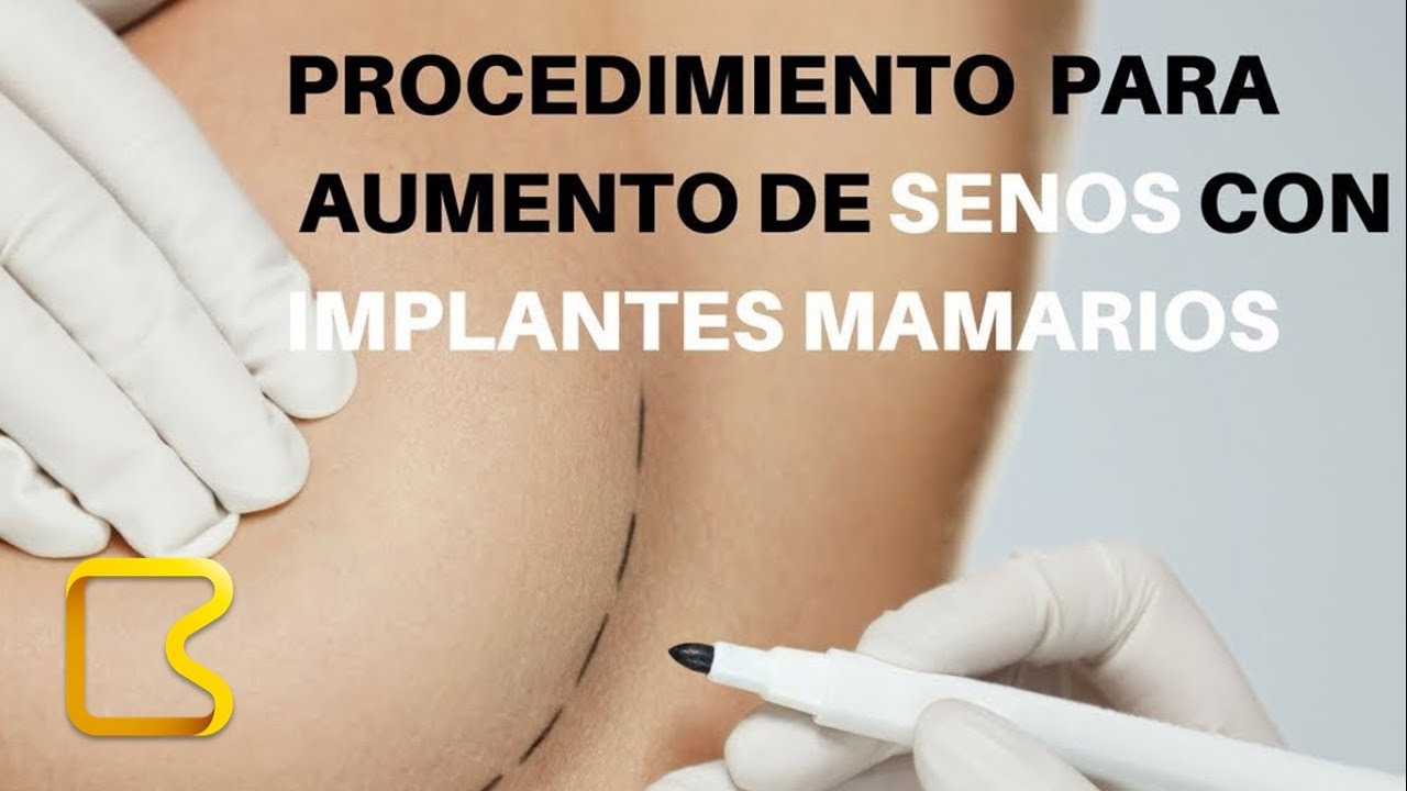 Watch Procedimiento de cirugía de implantes mamarios para aumento de senos Now Procedimiento de cirugía de implantes mamarios para aumento de senos