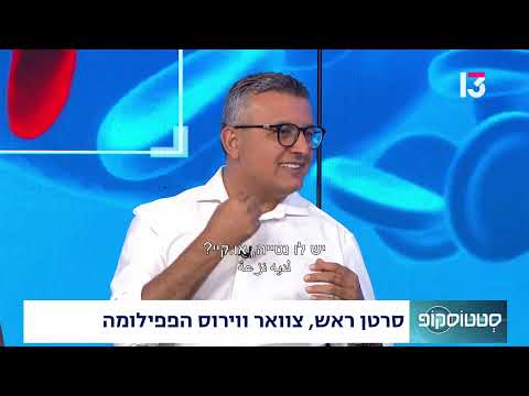  סרטן ראש, צוואר ווירוס הפפילומה